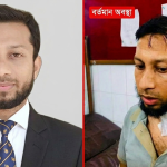 নারায়ণগঞ্জে ডাকাতের হামলায় এসিল্যান্ড আহত