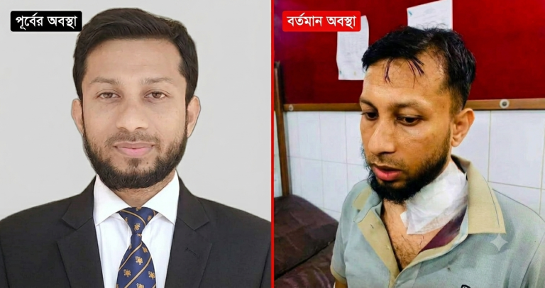 নারায়ণগঞ্জে ডাকাতের হামলায় এসিল্যান্ড আহত